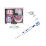 KIT MONITOR + TELECAMERA INTRAORALE + BRACCIO mostra 4 primi piani di denti e gengive.
