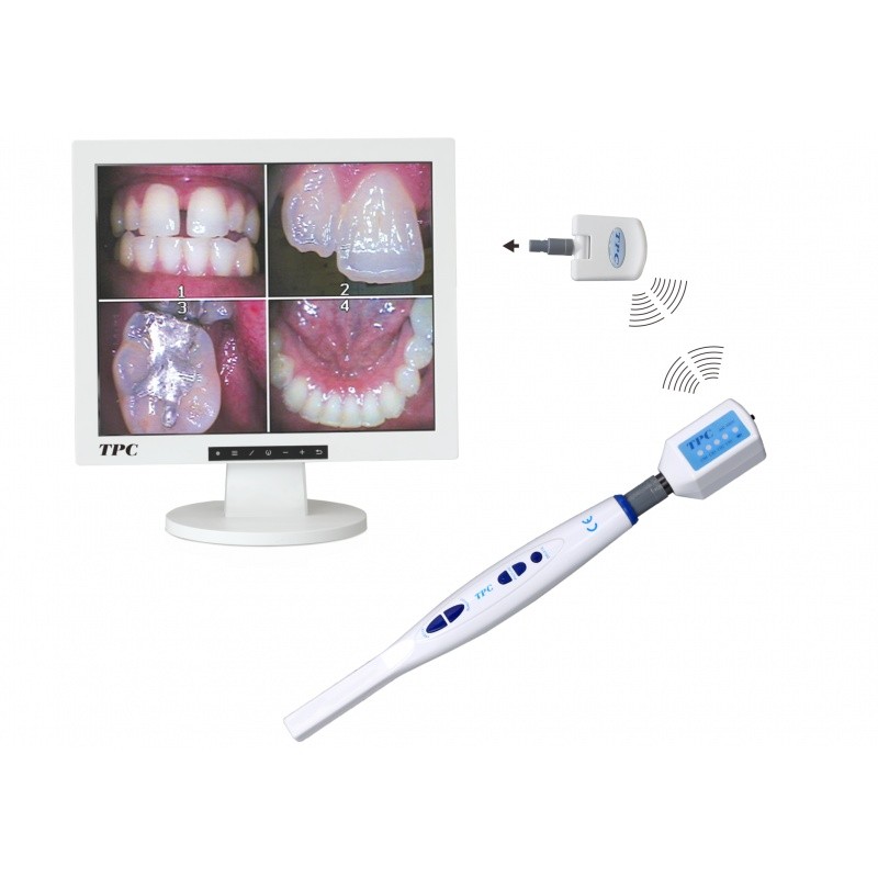 KIT MONITOR + TELECAMERA INTRAORALE + BRACCIO mostra 4 primi piani di denti e gengive.