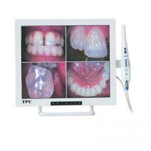 KIT MONITOR + TELECAMERA INTRAORALE + BRACCIO mostra 4 primi piani di denti e gengive.