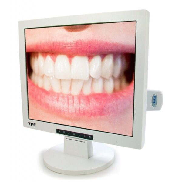KIT MONITOR + TELECAMERA INTRAORALE + BRACCIO che mostra un primo piano di denti sorridenti.
