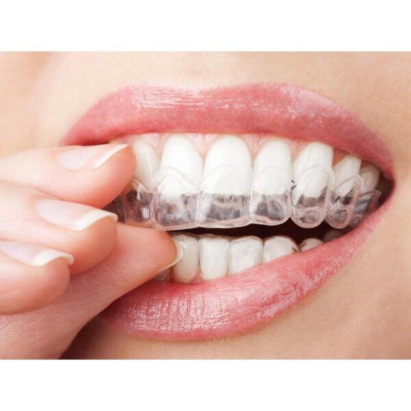 Someone fitting the GHOST ALIGNER - 0,50 MM - Ø 120 over their upper teeth.