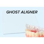 GHOST ALIGNER - 0,50 MM - Ø 125 clear aligner on a dental model.