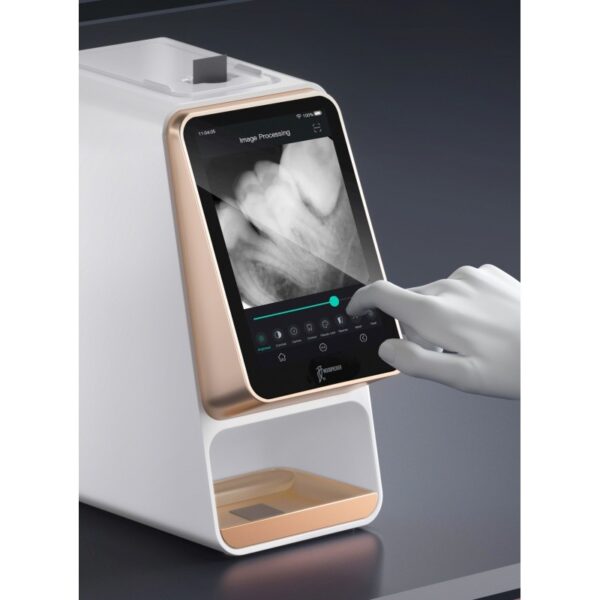 Una mano regge un dispositivo i-Scan che mostra un'immagine radiografica dentale da elaborare.