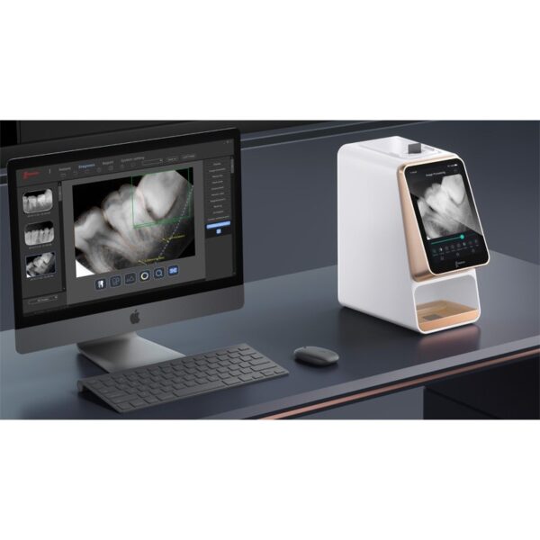 i-Scan Un dispositivo i-Scan accanto a un computer visualizza le immagini radiografiche dentali.