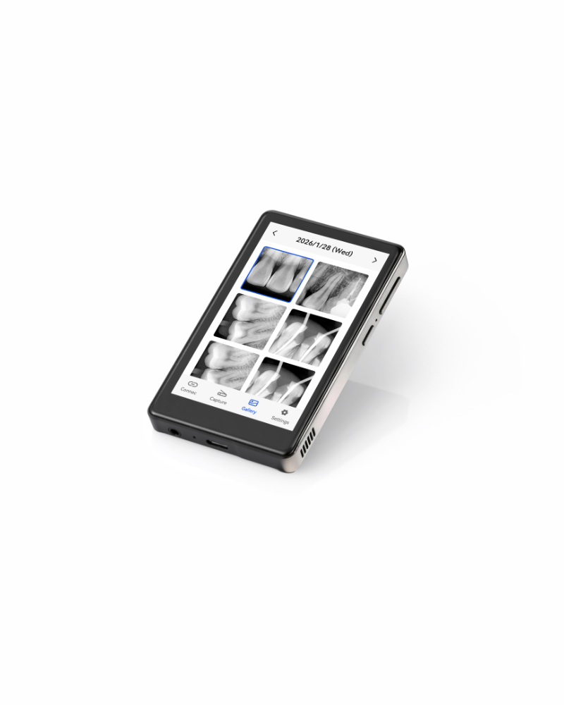 Un dispositivo portatile di De Giorgi Store visualizza sullo schermo immagini radiografiche dentali.